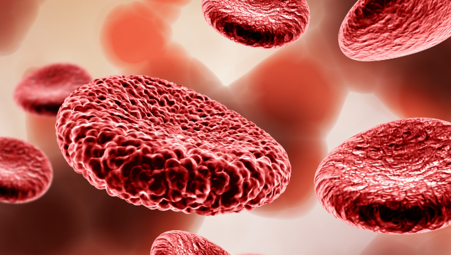 Anemia A Brief Overview